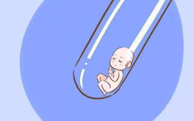 孕妇止吐