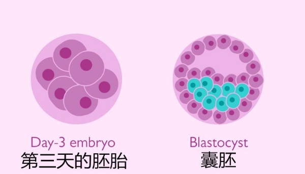 孕妇早产