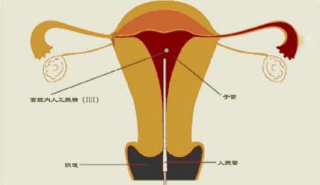 宝妈
