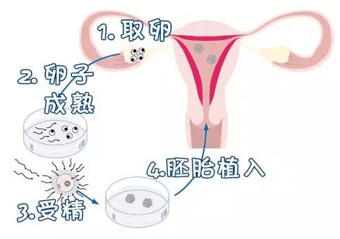 孕妇