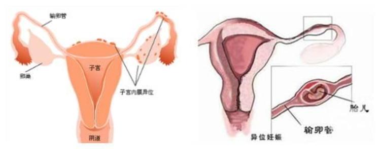 孕妇