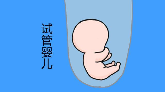 孕妇血型检查