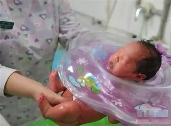 孕妇早产