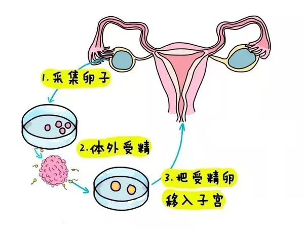 孕妇最怕的九大辐射
