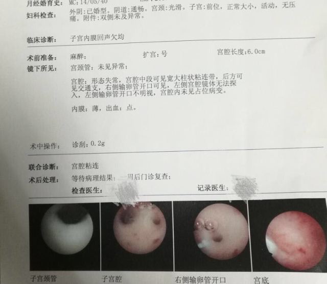 宝宝高烧