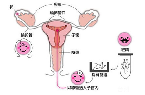 孕妇感冒